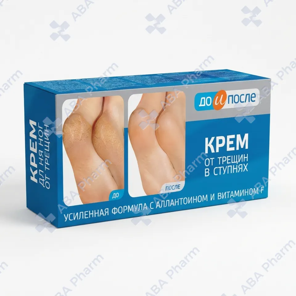 Do I Posle cream for cracked feet 50ml №1